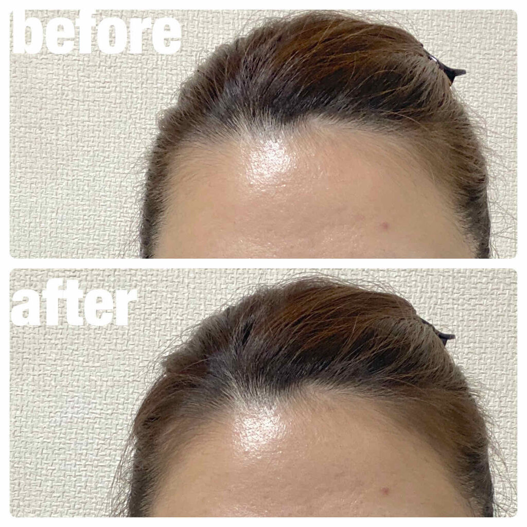 デコシャドウ by.F/Fujiko/シェーディングを使ったクチコミ（3枚目）