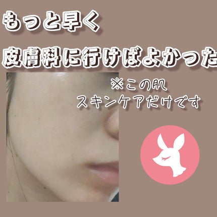 化粧水・敏感肌用・しっとりタイプ/無印良品/化粧水を使ったクチコミ(1枚目)