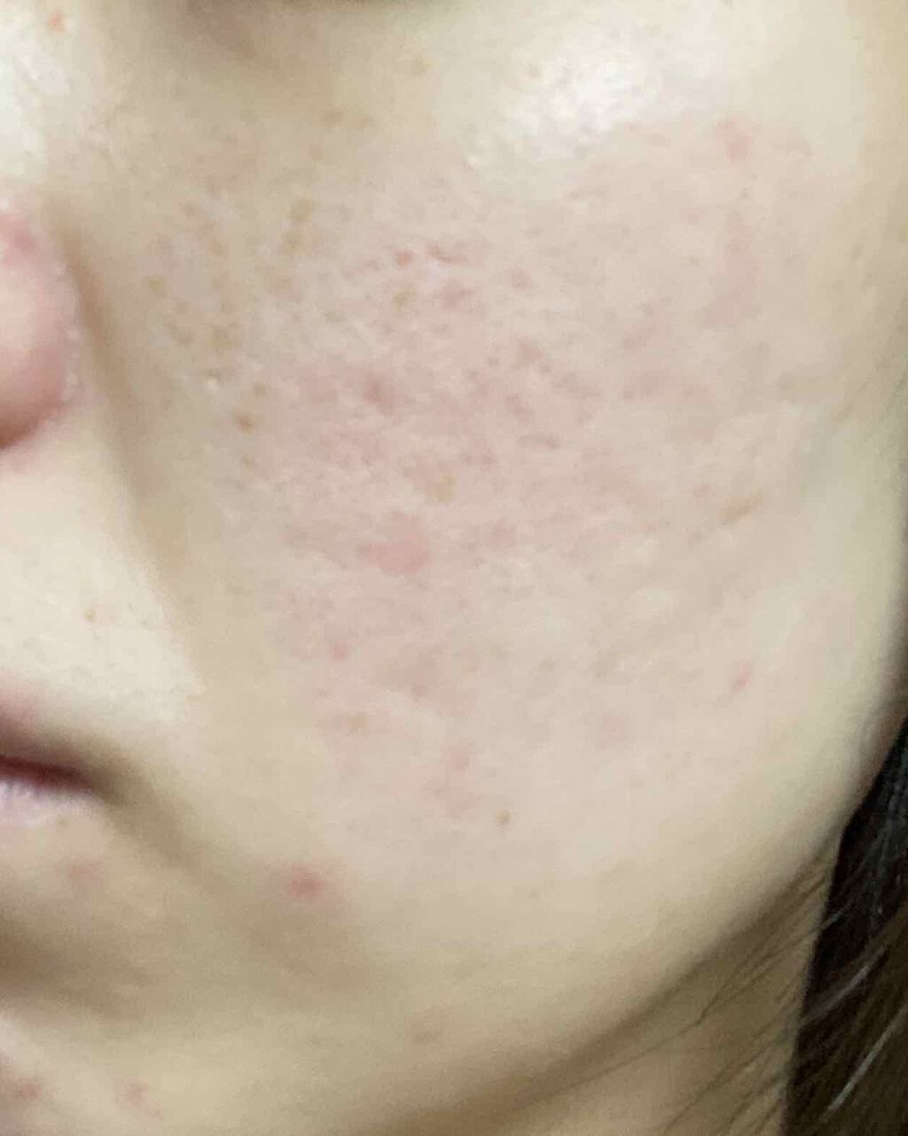 ザ・タイムR アクア/IPSA/化粧水を使ったクチコミ（2枚目）