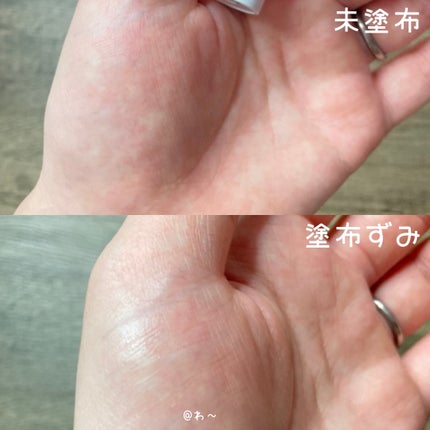 薬用ホワイトニングリフトケアスーパーCスティック/シミウス/その他スキンケアを使ったクチコミ(5枚目)