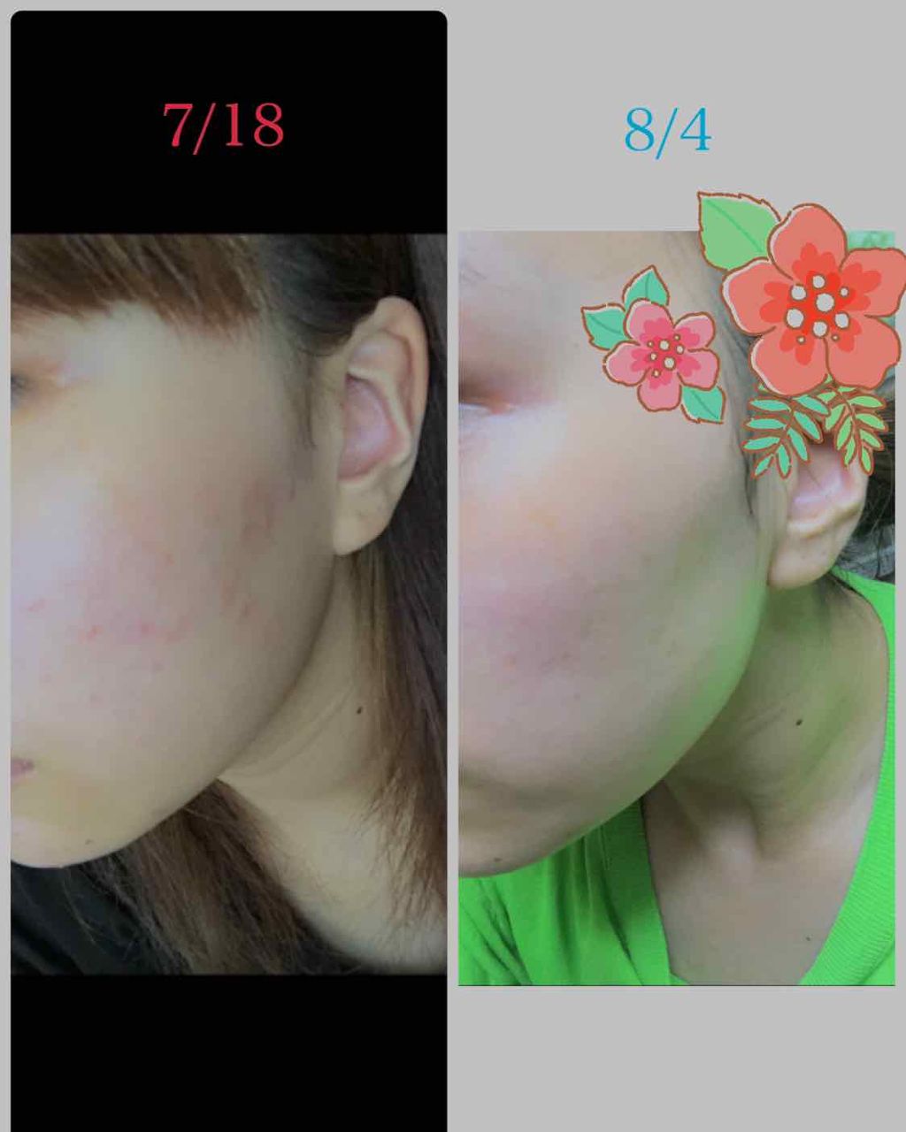 オードムーゲ 薬用ローション(ふきとり化粧水)/オードムーゲ/拭き取り化粧水を使ったクチコミ(1枚目)