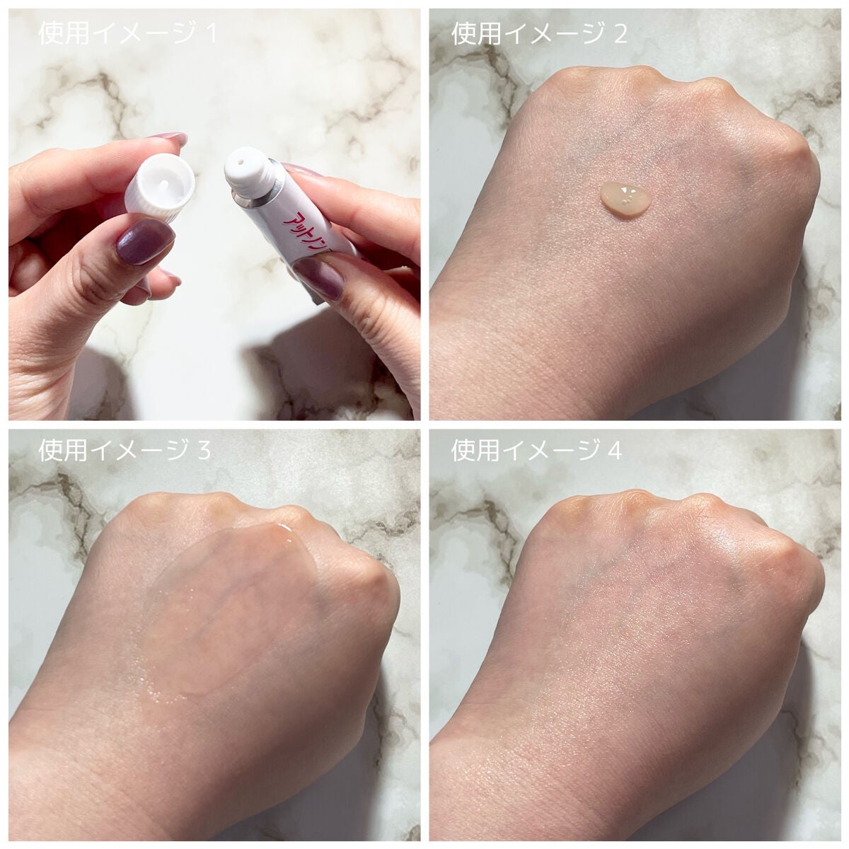 ニキビあとケアジェル/アットノン/その他スキンケアを使ったクチコミ(7枚目)