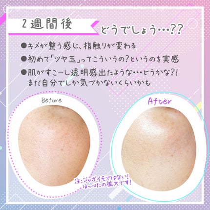 スピラコレッタ UVトリートメントミルクWTSP /日本ライフ製薬/化粧下地を使ったクチコミ(6枚目)