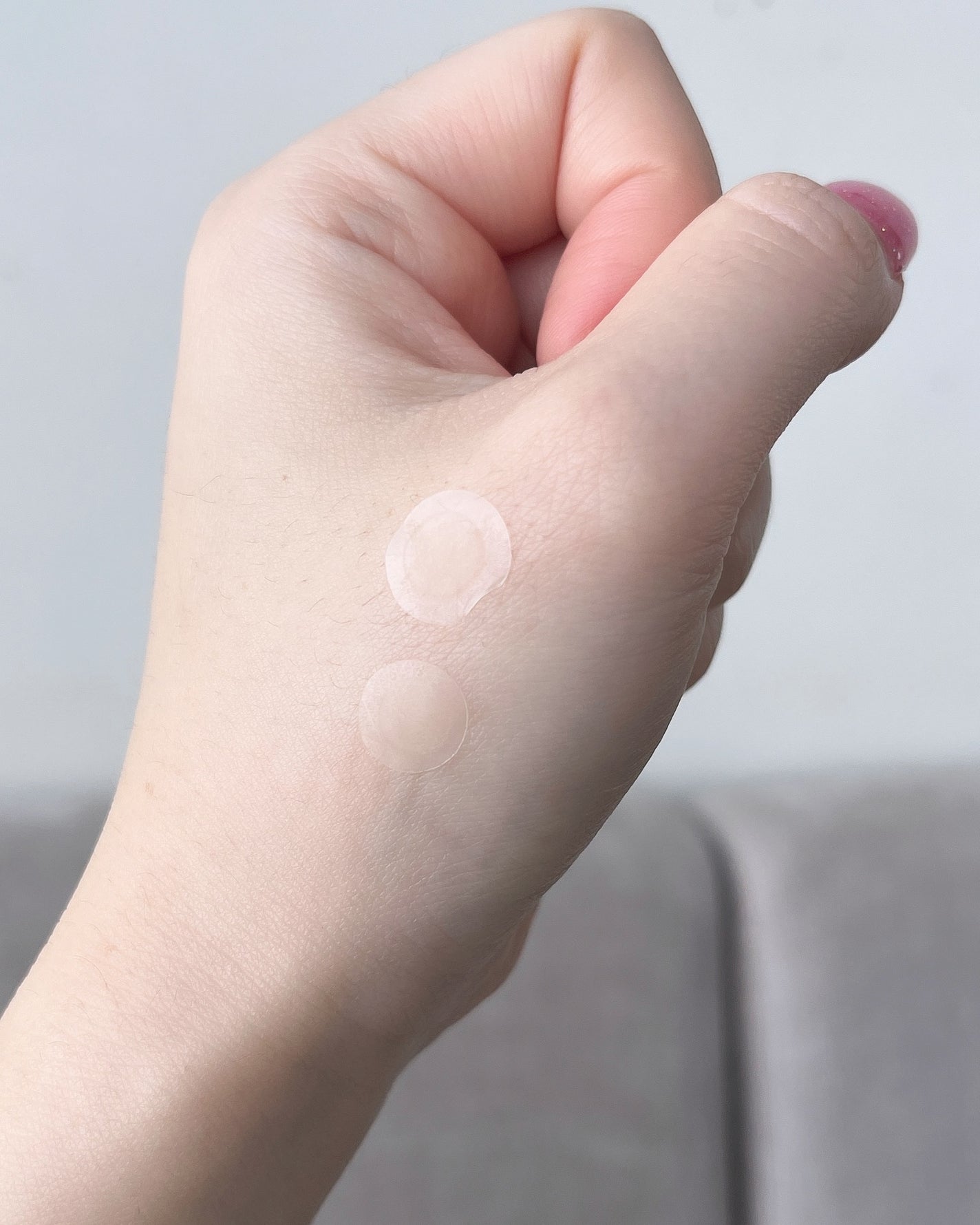 ビューティー スポットパッチ/イージーダムビューティー/にきびパッチを使ったクチコミ(4枚目)