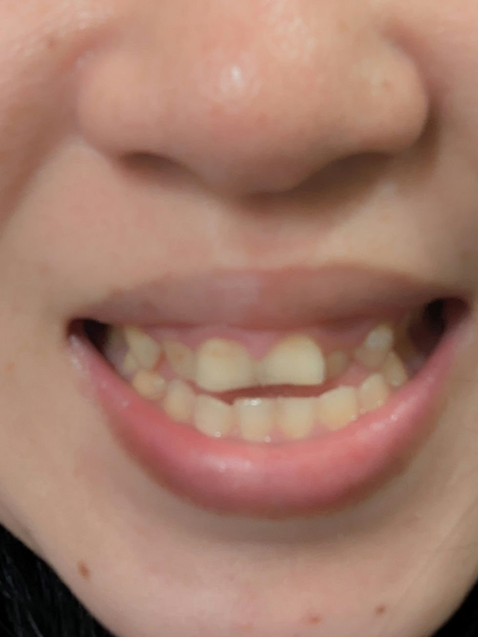 アパガードMプラス 63g/アパガード/歯磨き粉を使ったクチコミ（2枚目）