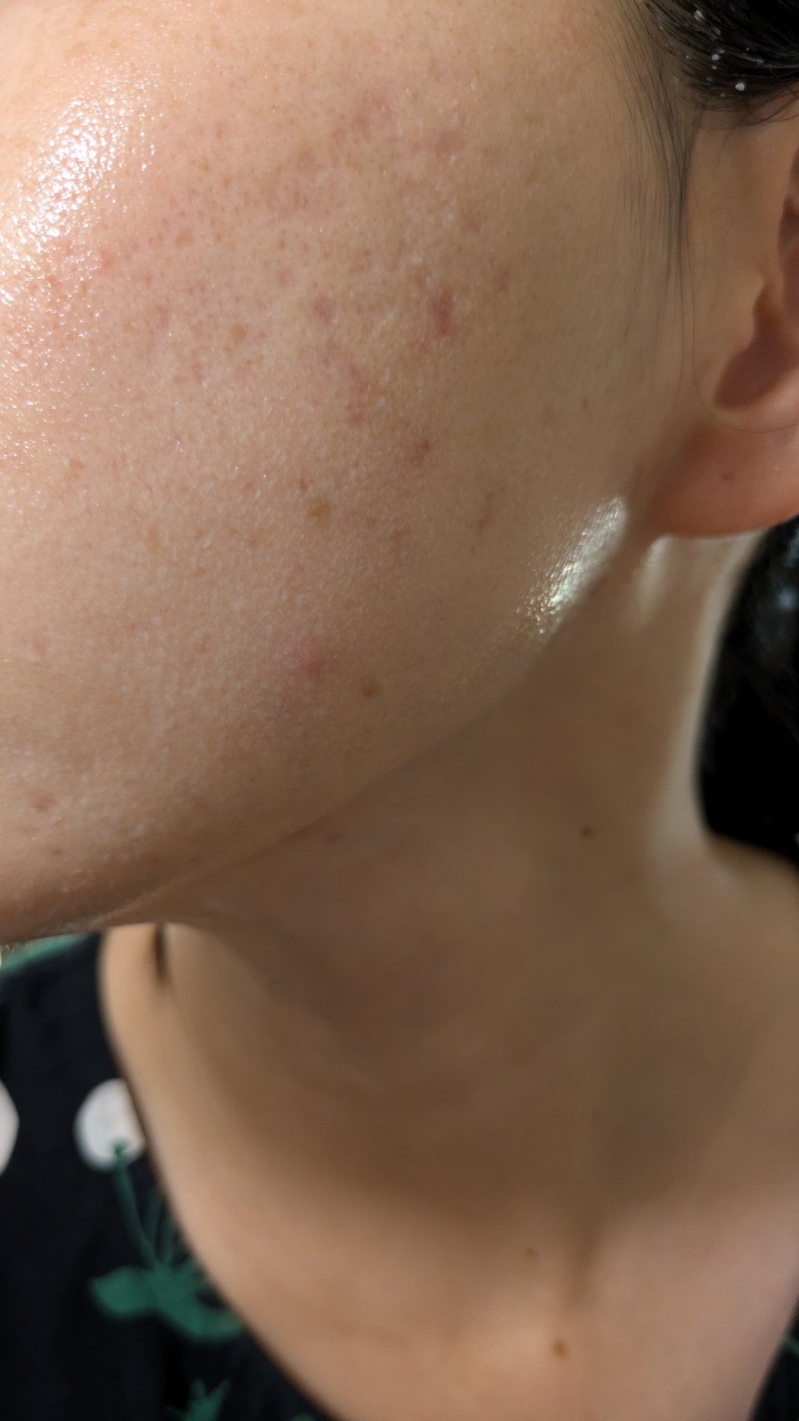 N10+Z1フェイスセラム /The Ordinary/美容液を使ったクチコミ（2枚目）