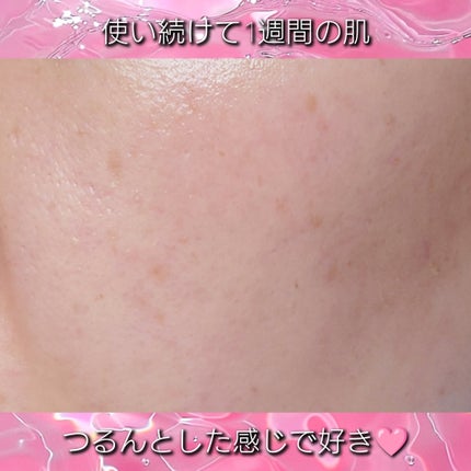 ピンクアロエビタトナー/APRILSKIN/化粧水を使ったクチコミ(5枚目)