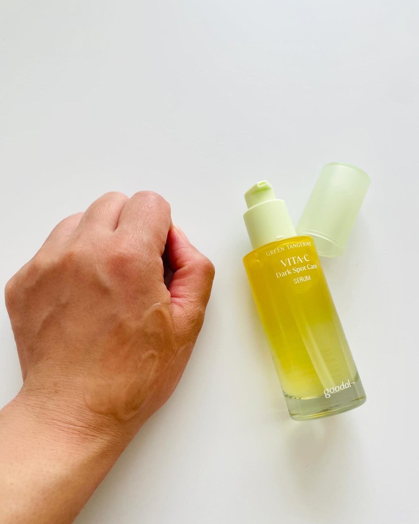 たかみ♡フォロバします on LIPS 「.1年前にシミケアトリートメントを6回受けて完全になくなること..」(3枚目)