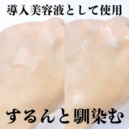 p/d 美容液/p/d/美容液を使ったクチコミ(4枚目)