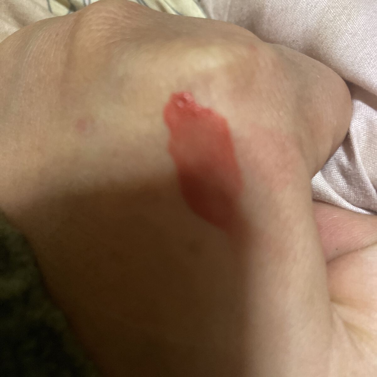 フィクシングティント メロウピーチ（新パッケージ）/ETUDE/リップティントを使ったクチコミ（1枚目）