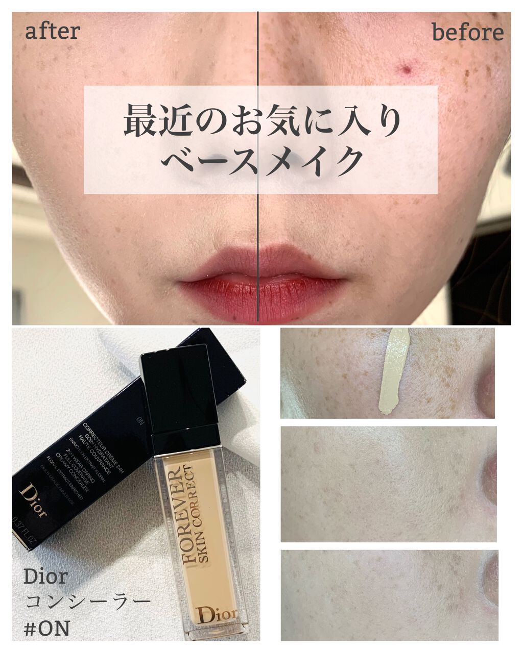 【旧】ディオールスキン フォーエヴァー スキン コレクト コンシーラー/Dior/リキッドコンシーラーを使ったクチコミ（1枚目）