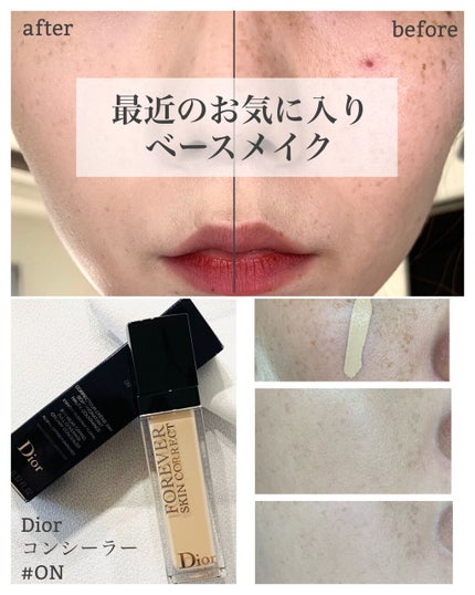 【旧】ディオールスキン フォーエヴァー スキン コレクト コンシーラー/Dior/リキッドコンシーラーを使ったクチコミ(1枚目)