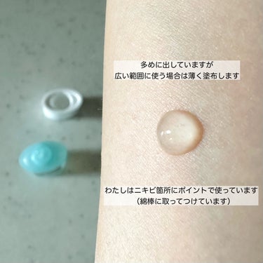 CLINIQUE アクネ クリアリング ジェルのクチコミ「20代から使ってるニキビ用ジェル✨

CLINIQUE
アクネ クリアリング ジェル
〈医薬部.....」（2枚目）