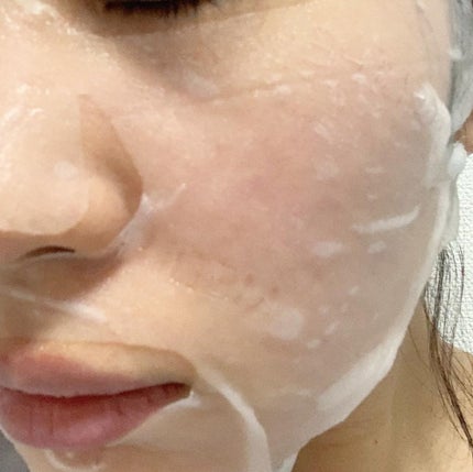 ビタライトビームエッセンシャルマスクEX/MEDIHEAL/シートマスク・パックを使ったクチコミ(3枚目)