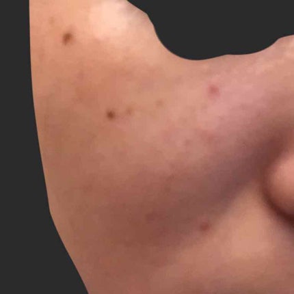 悩める学生 on LIPS 「#スガオ,素顔#肌荒れ赤み#シミそばかす#助けてください恥ずか..」(1枚目)