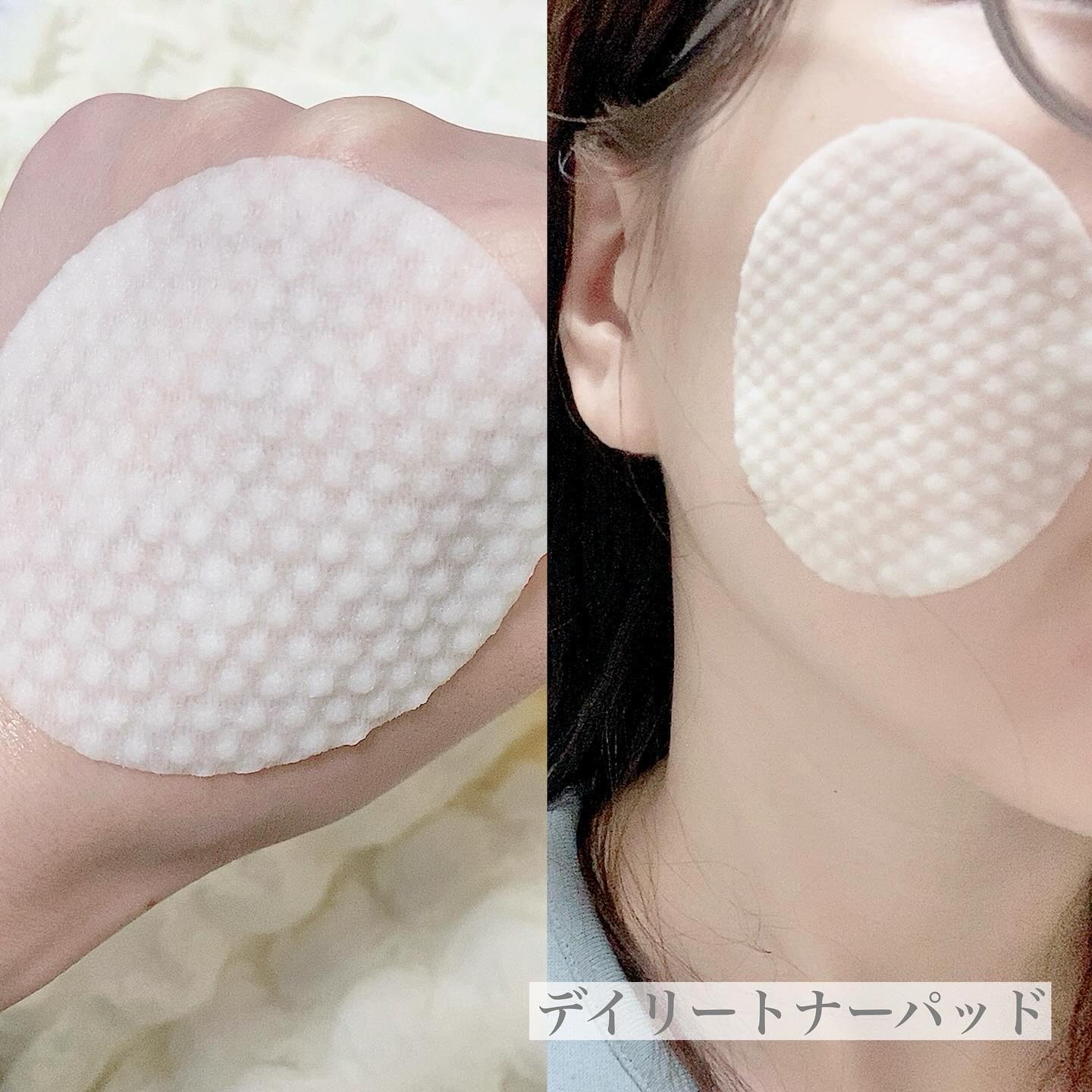 オーマイイージー デイリーポイントケアパッド MO　/ウテナ/トナーパッドを使ったクチコミ（2枚目）