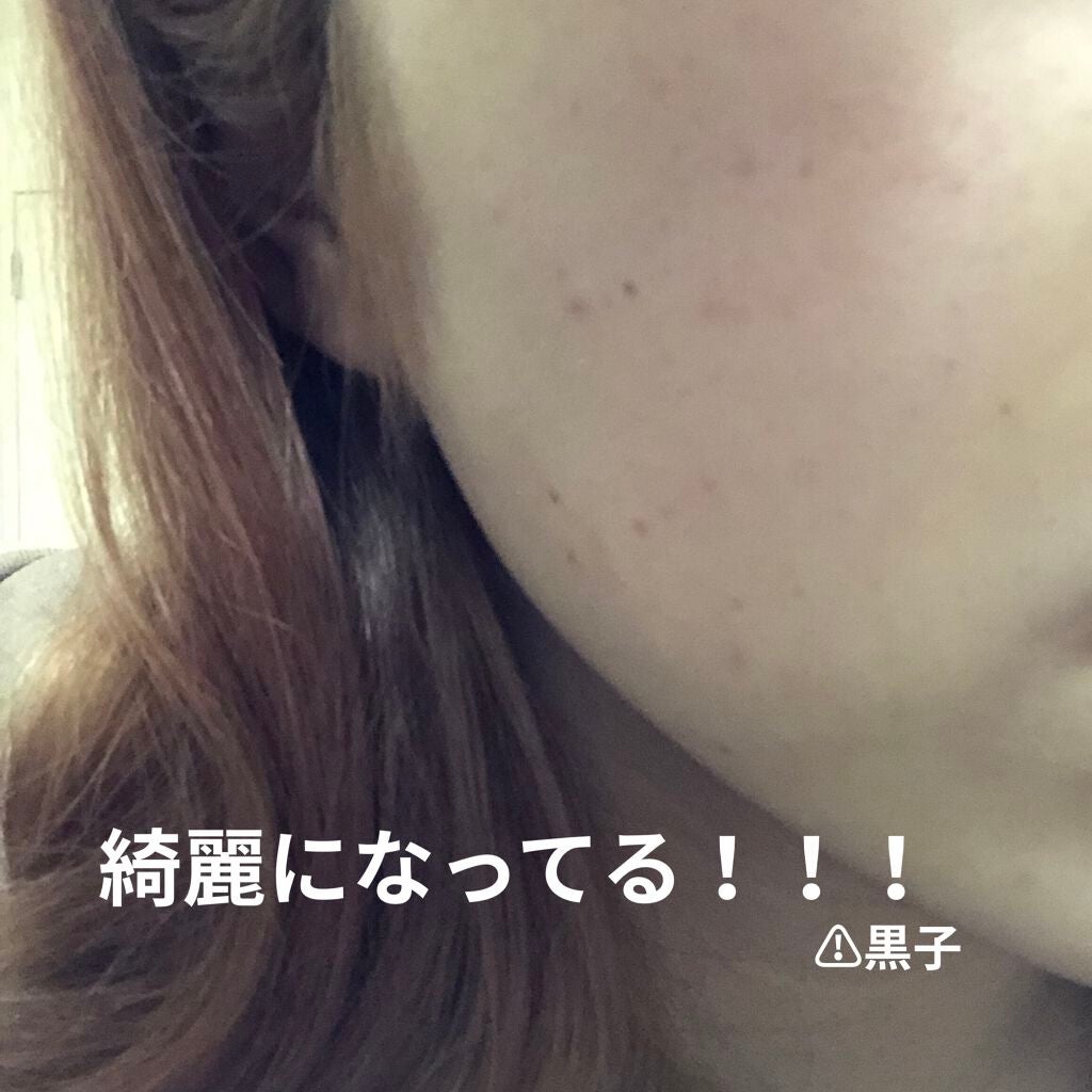 オロナインH軟膏 (医薬品)/オロナイン/その他を使ったクチコミ(1枚目)