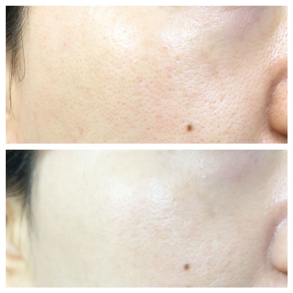 D-UVクリア ホワイトソリューション/アスタリフト/日焼け止めクリームを使ったクチコミ(4枚目)