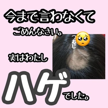 
〜いきなりのカミングアウト〜
　⇒実は私、円形脱毛症でした。

今回投稿するか悩んだのですが
私が円形脱毛症になった時
何が効くのか(商品の評価も含めて)
なぜ発症したのかを
毎日のように、ネット、イ