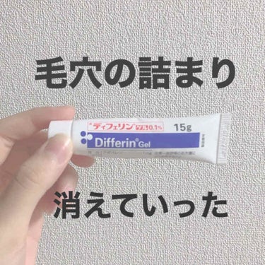 ジア on LIPS 「毛穴の詰まりに悩んでる人、絶対に試してください。私は昔から鼻や..」（1枚目）