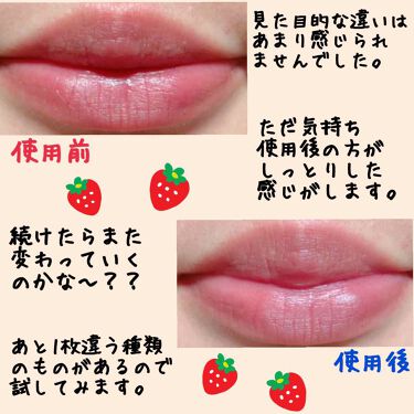 リップパック Choosyの口コミ チューシーのハイドロゲルリップパックのレビ By ルイ 混合肌 30代前半 Lips