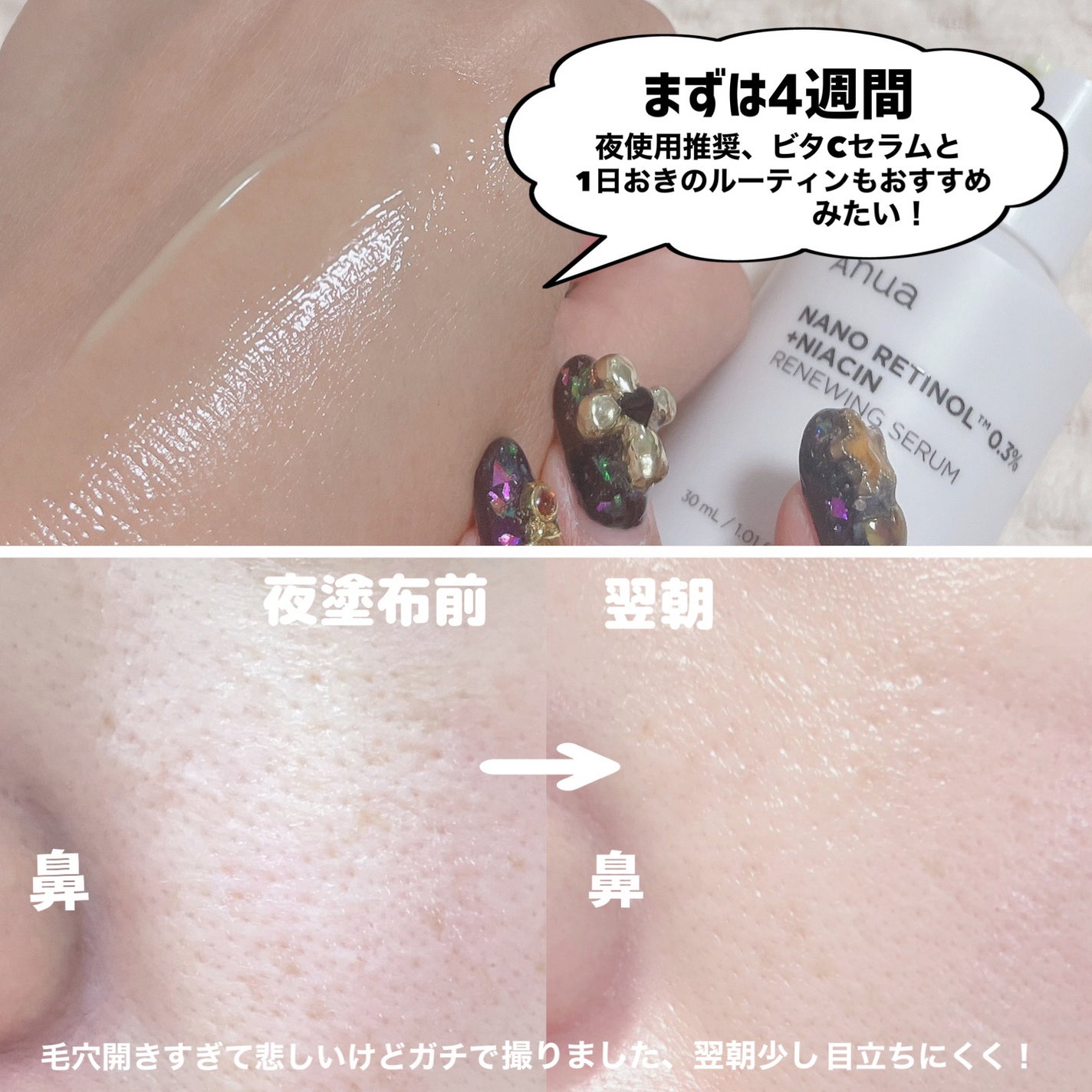 ドクダミ 77 スージングトナー/Anua/化粧水を使ったクチコミ(6枚目)