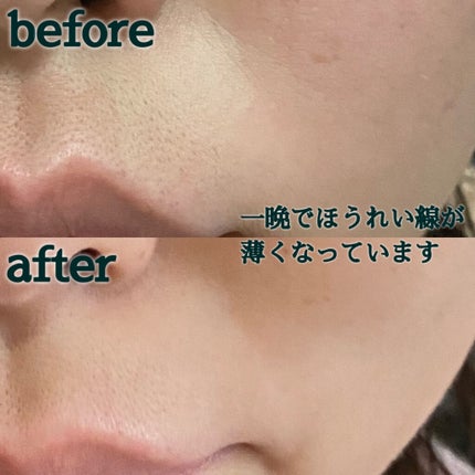 フィルナチュラント IC.U アルジェックス/ドクターフィルコスメティクス/美容液を使ったクチコミ(4枚目)