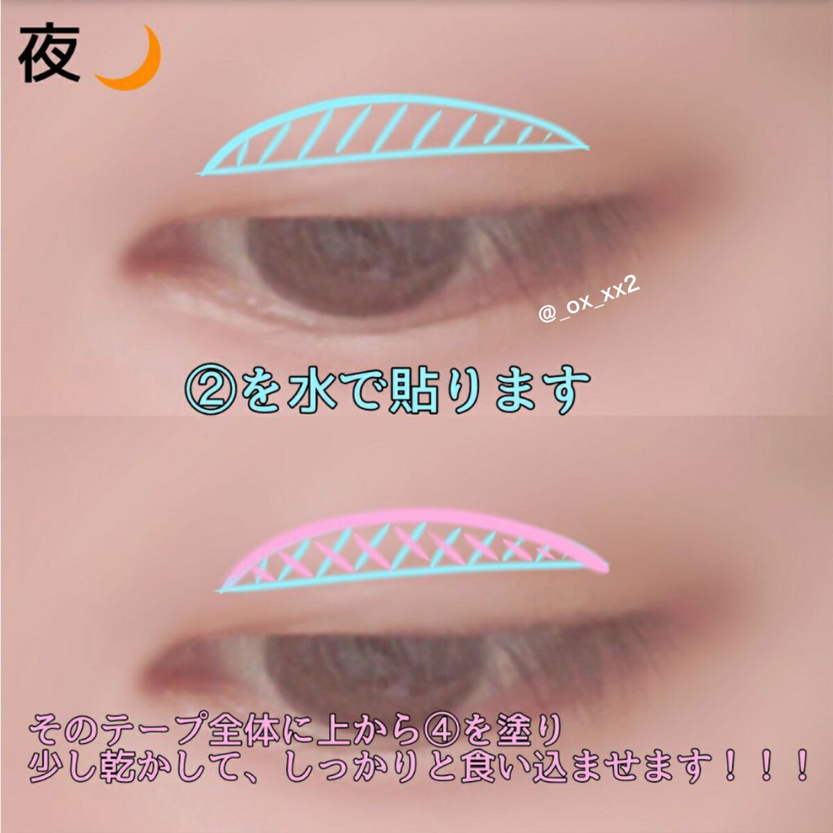 アイプチ/セリア/二重まぶた用アイテムを使ったクチコミ(5枚目)