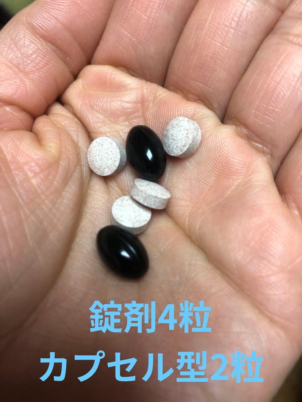 Whiteasy L-シスチン・ビタミンE含有加工食品/合一製薬/美容サプリメントを使ったクチコミ(3枚目)