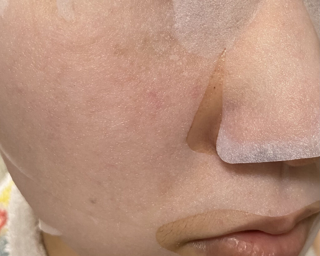 ホワイトマスクN/透明白肌/シートマスク・パックを使ったクチコミ（2枚目）