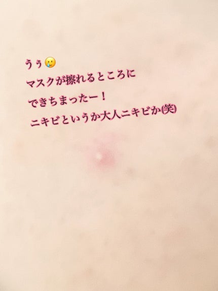 プロCICA クリアスポットパッチ/VT/その他スキンケアを使ったクチコミ(3枚目)