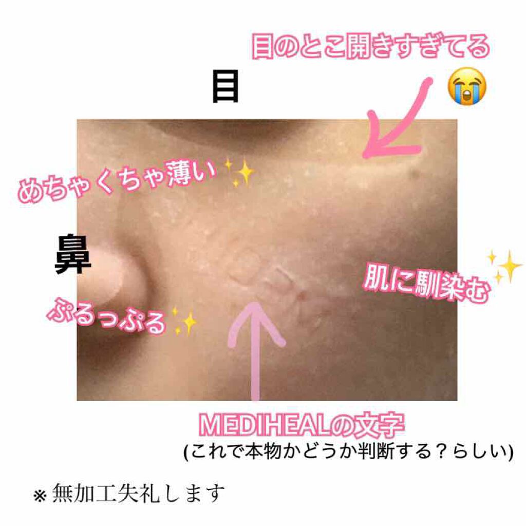 N.M.FアクアアンプルマスクJEX/MEDIHEAL/シートマスク・パックを使ったクチコミ(2枚目)