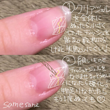引き付ける 運賃 静的 ジェル ネイル ティッシュ 補強 糸 コンクリート マーティンルーサーキングジュニア
