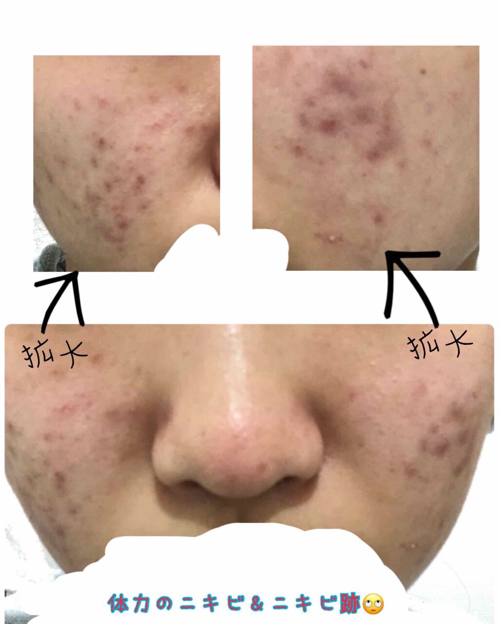 オバジC10セラム/オバジ/美容液を使ったクチコミ（2枚目）