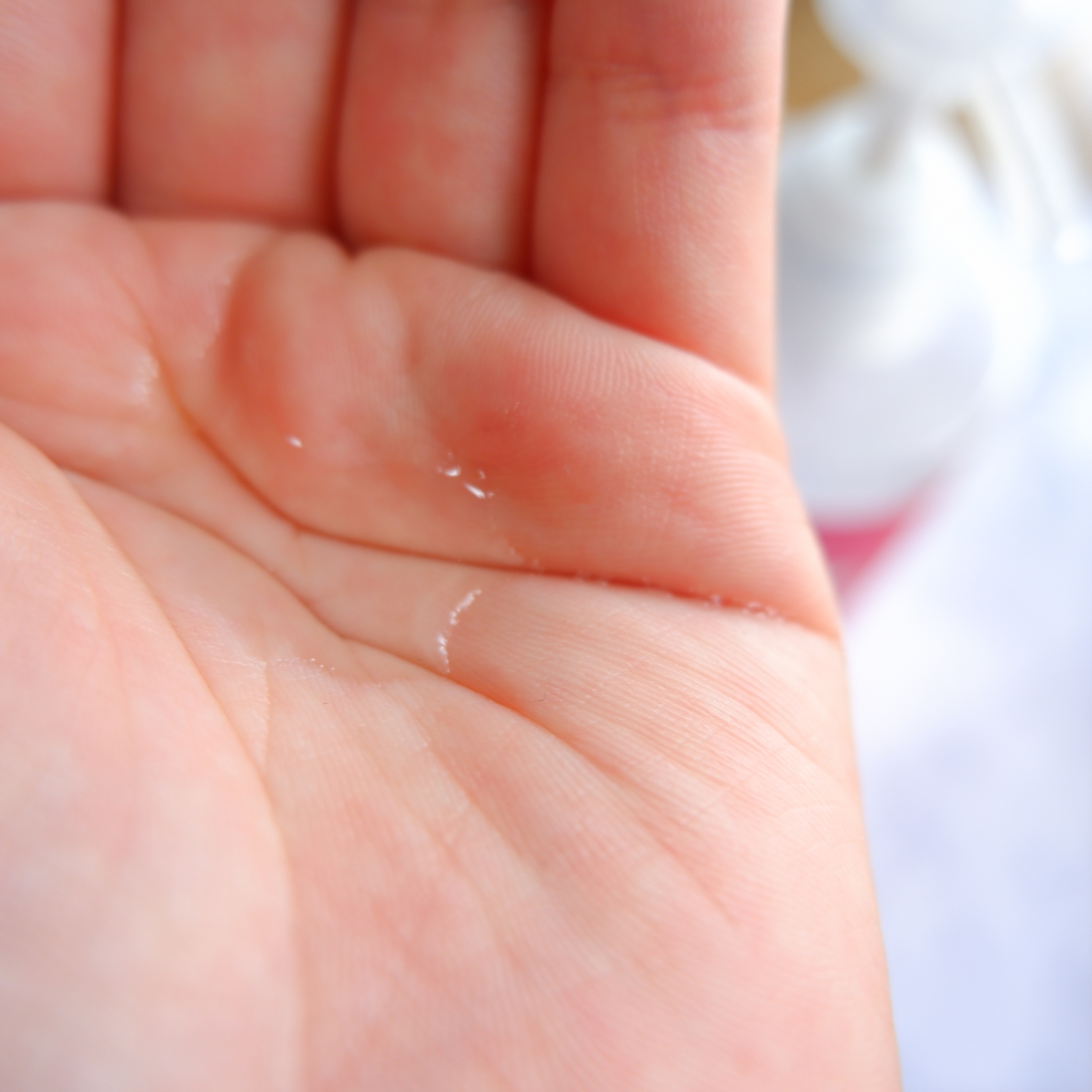 ヘパトリート 薬用保湿化粧水/ゼトックスタイル/化粧水を使ったクチコミ（2枚目）