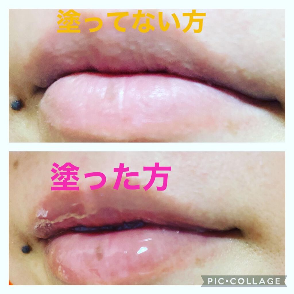 プランプ&フィックスリップコート/メイクハック/リップグロスを使ったクチコミ(4枚目)