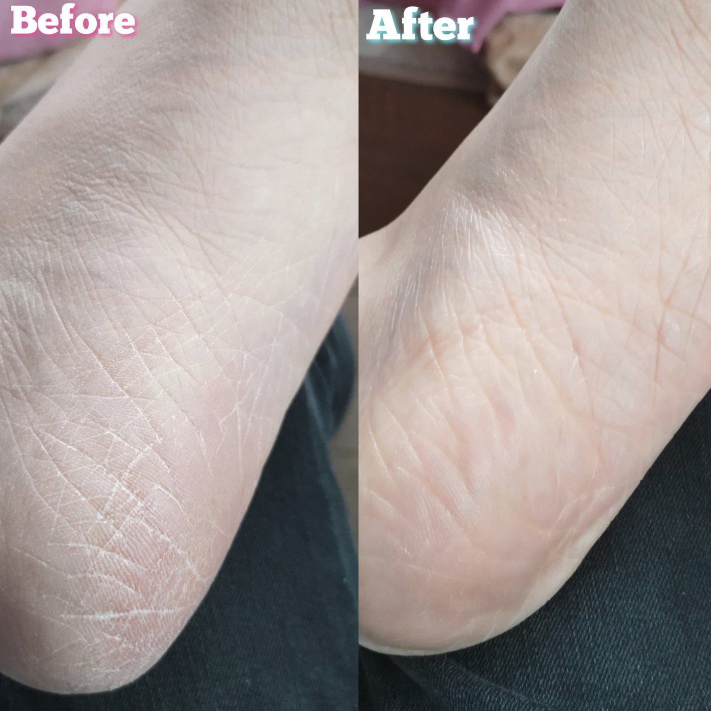 シルキーココナッツオイルフットマスク /MADFORCOS/レッグ・フットケアを使ったクチコミ(7枚目)