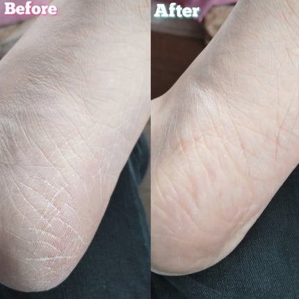 シルキーココナッツオイルフットマスク /MADFORCOS/レッグ・フットケアを使ったクチコミ(7枚目)