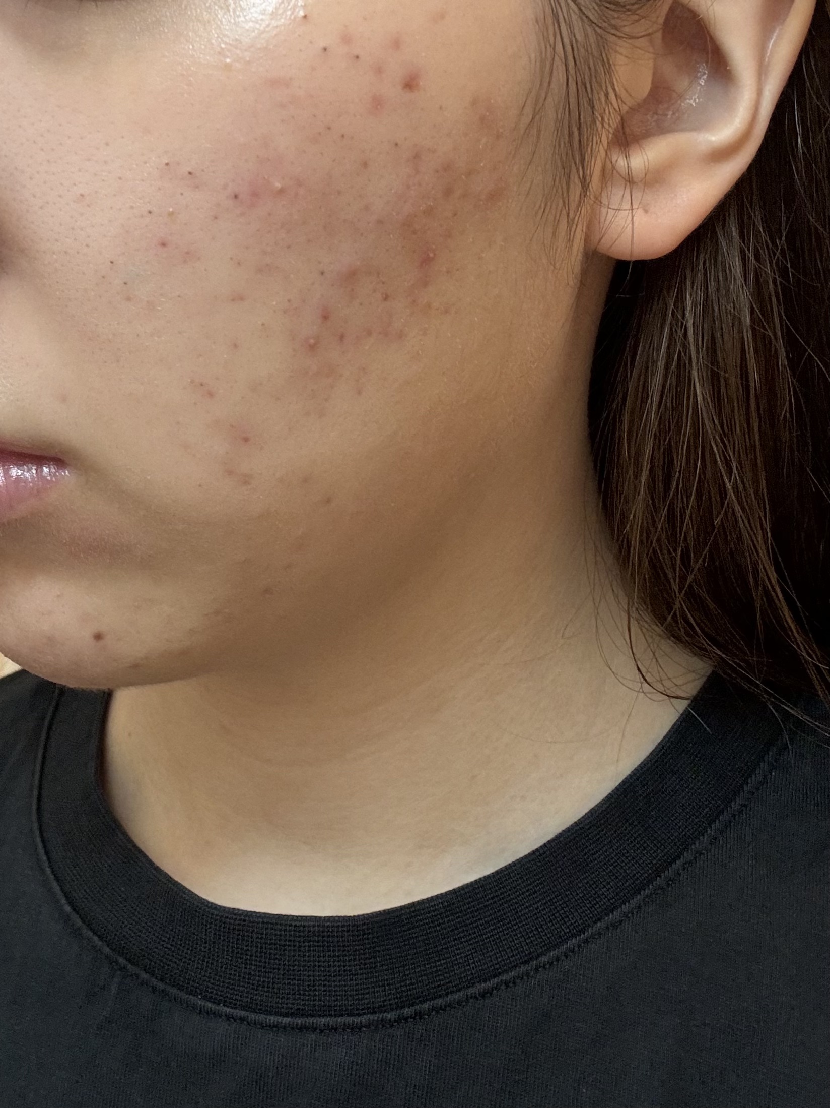 浸透湿潤セラミド１０％★ナノエマルジョン/TOUT VERT/乳液を使ったクチコミ（2枚目）