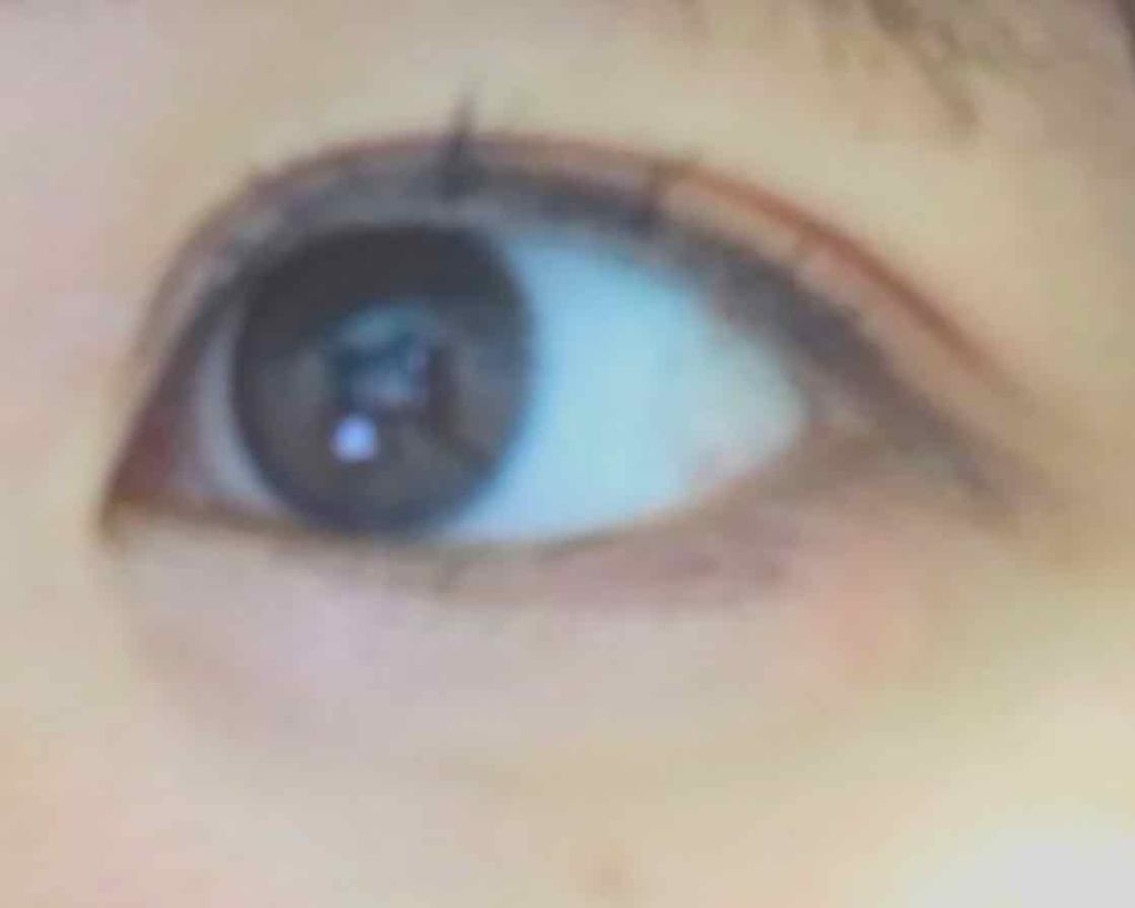 のびーるアイテープ(絆創膏タイプ、レギュラー)/DAISO/二重まぶた用アイテムを使ったクチコミ(1枚目)