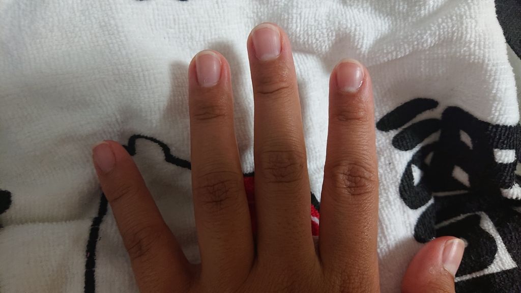 グロッシーコート/スキューズミー/オールインワンネイルを使ったクチコミ（1枚目）