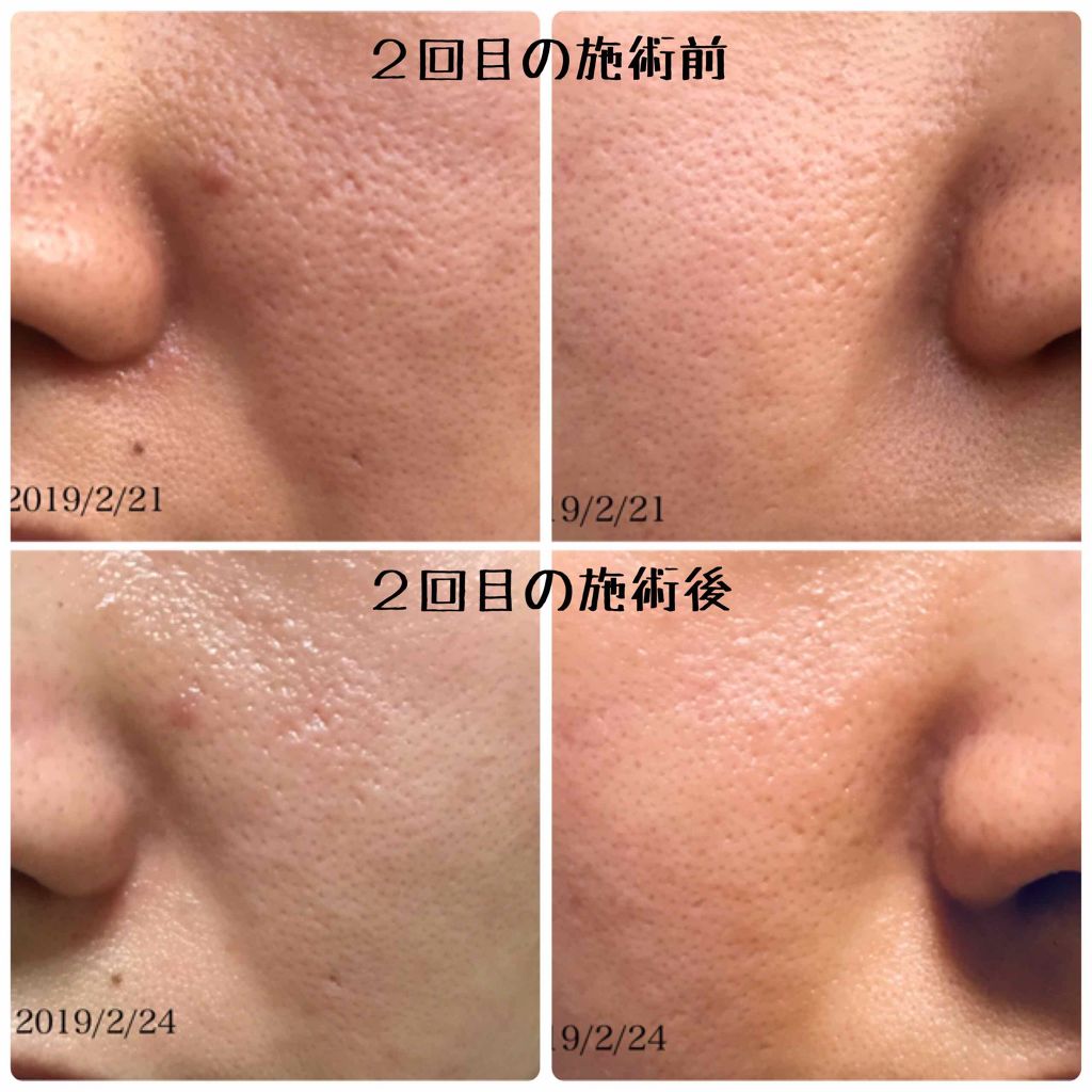 を使ったクチコミ（2枚目）