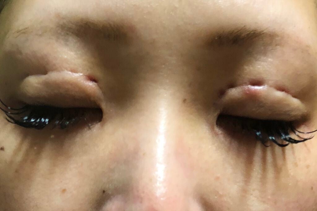 aikam on LIPS 「メイク動画upする前に…私、2回、整形しております。1回目20..」(3枚目)