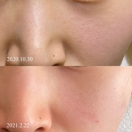 ドクタージャルト シカペアセラム /Dr.Jart+/美容液を使ったクチコミ(2枚目)