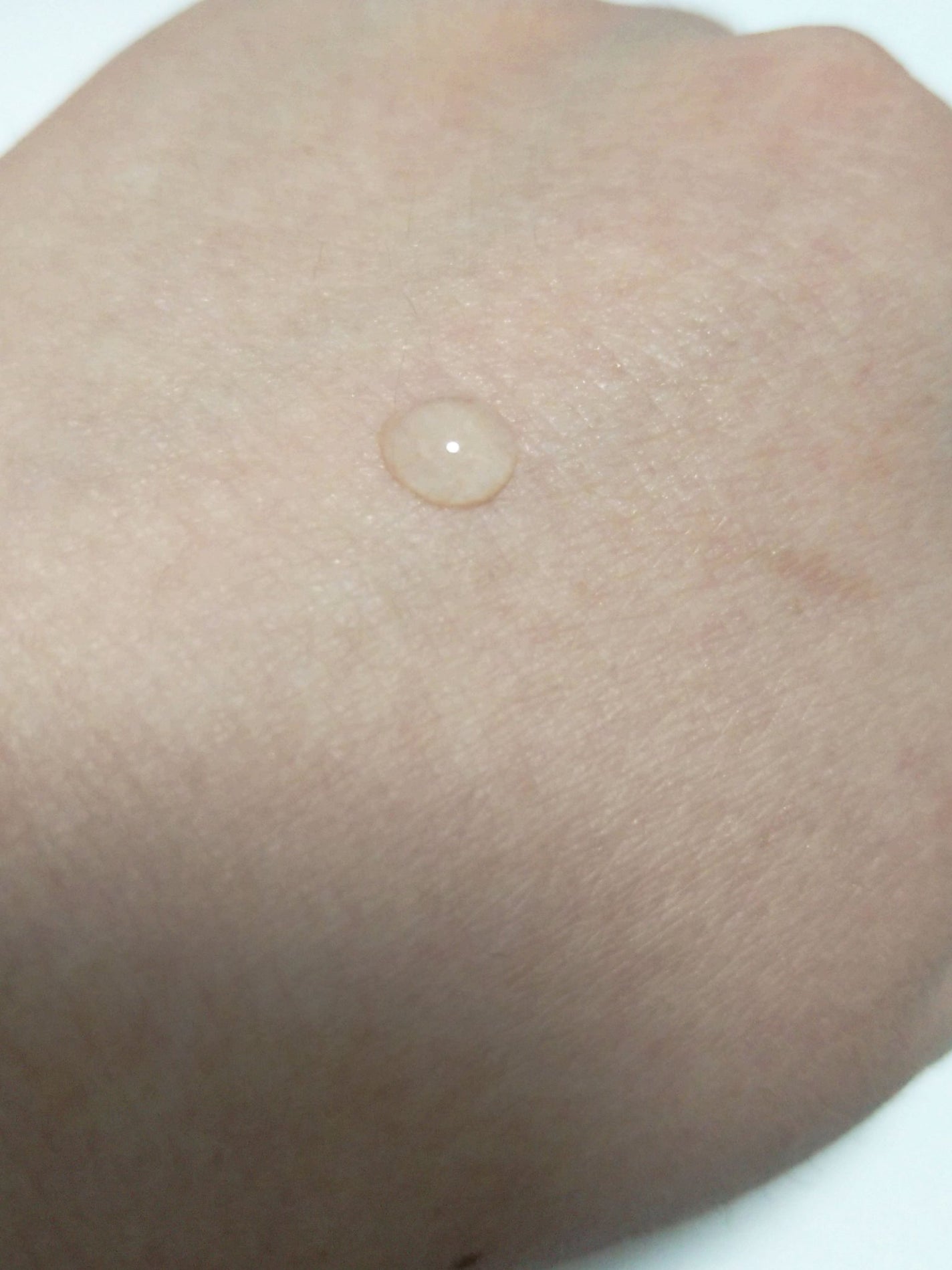 ダーマレーザー ウルセラC/クオリティファースト/美容液を使ったクチコミ(3枚目)