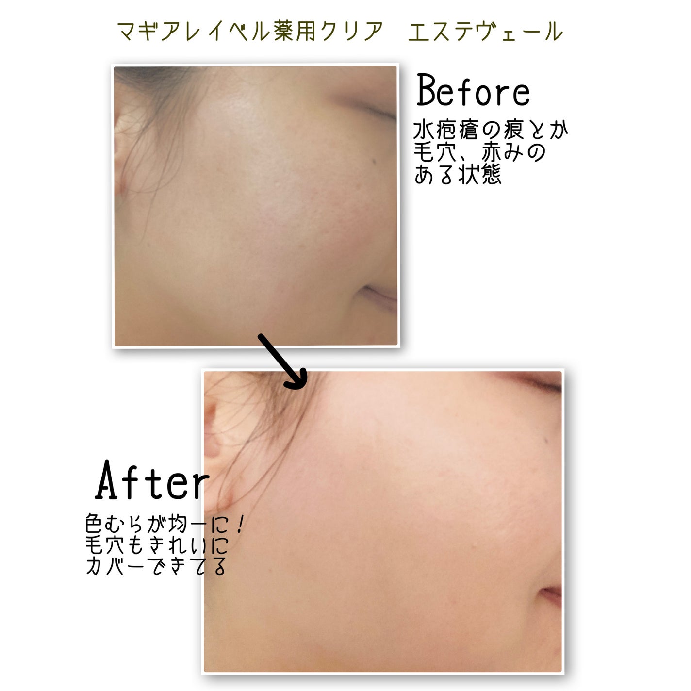 薬用クリアエステヴェール/Macchia Label/リキッドファンデーションを使ったクチコミ(3枚目)