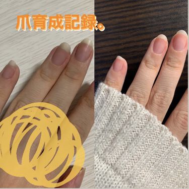 ネイルベッドオイル アンドネイルの口コミ 爪育成記録 1枚目写真左は今年の6月この日 By なにか 乾燥肌 代前半 Lips