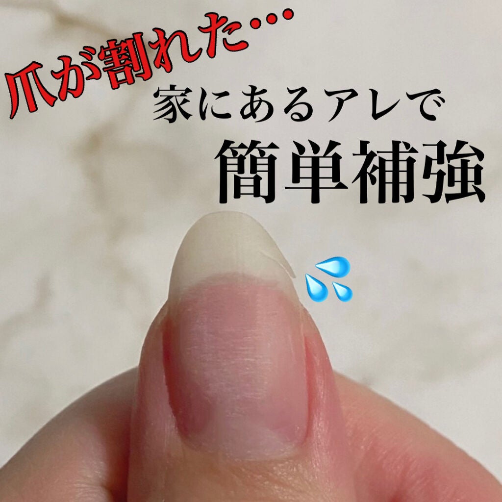 Shジェルネイル ライト対応 セリアの口コミ 超優秀 100均で買えるおすすめマニキュア 爪が割れたときの応急処置 家にあるアレで爪の簡単補強 By さあ 代前半 Lips Shジェルネイル ライト対応 セリアの口コミ 超優秀 100均で買えるおすすめマニキュア 爪が割れたときの応急処置 家にあるアレで爪の簡単補強 By さあ 代前半 Lips