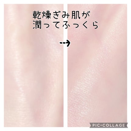 リードルショット100/VT/美容液を使ったクチコミ(10枚目)