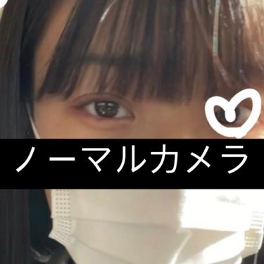 ﾐﾟ on LIPS 「【閲覧注意】術後写真あります。初めての二重整形レポ~眼瞼下垂編..」（2枚目）